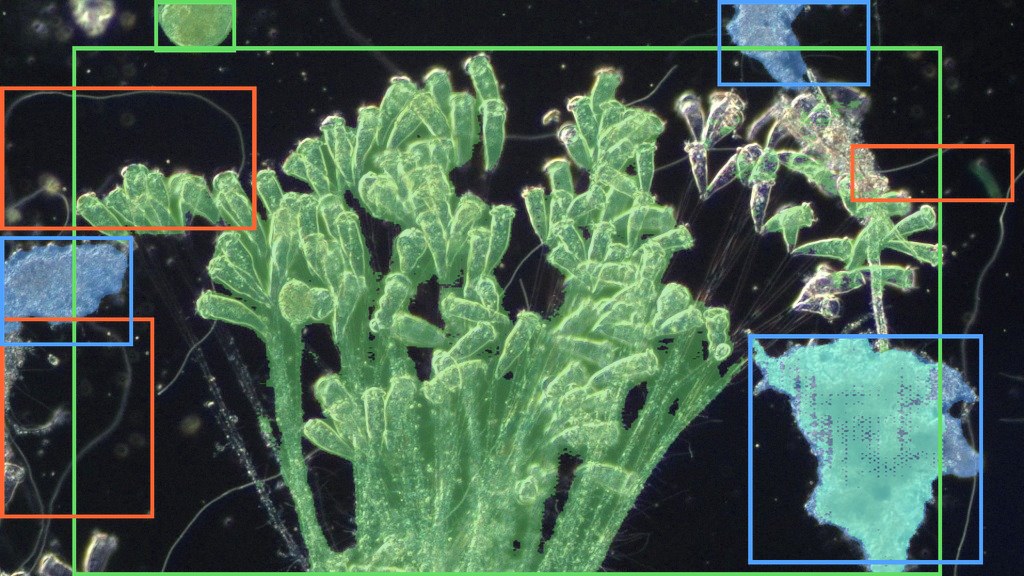 Anonymous plant microscopy sample from April 1 with Nymph AI Vision overlaid.