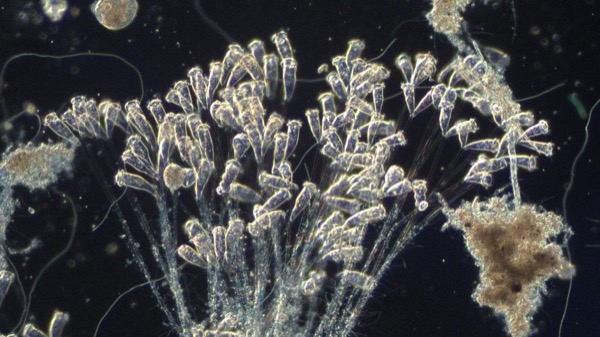 Microbiology from an operating wastewater plant
