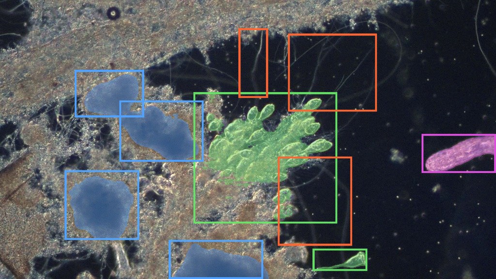 Anonymous plant microscopy sample from April 7 with Nymph AI Vision overlaid.