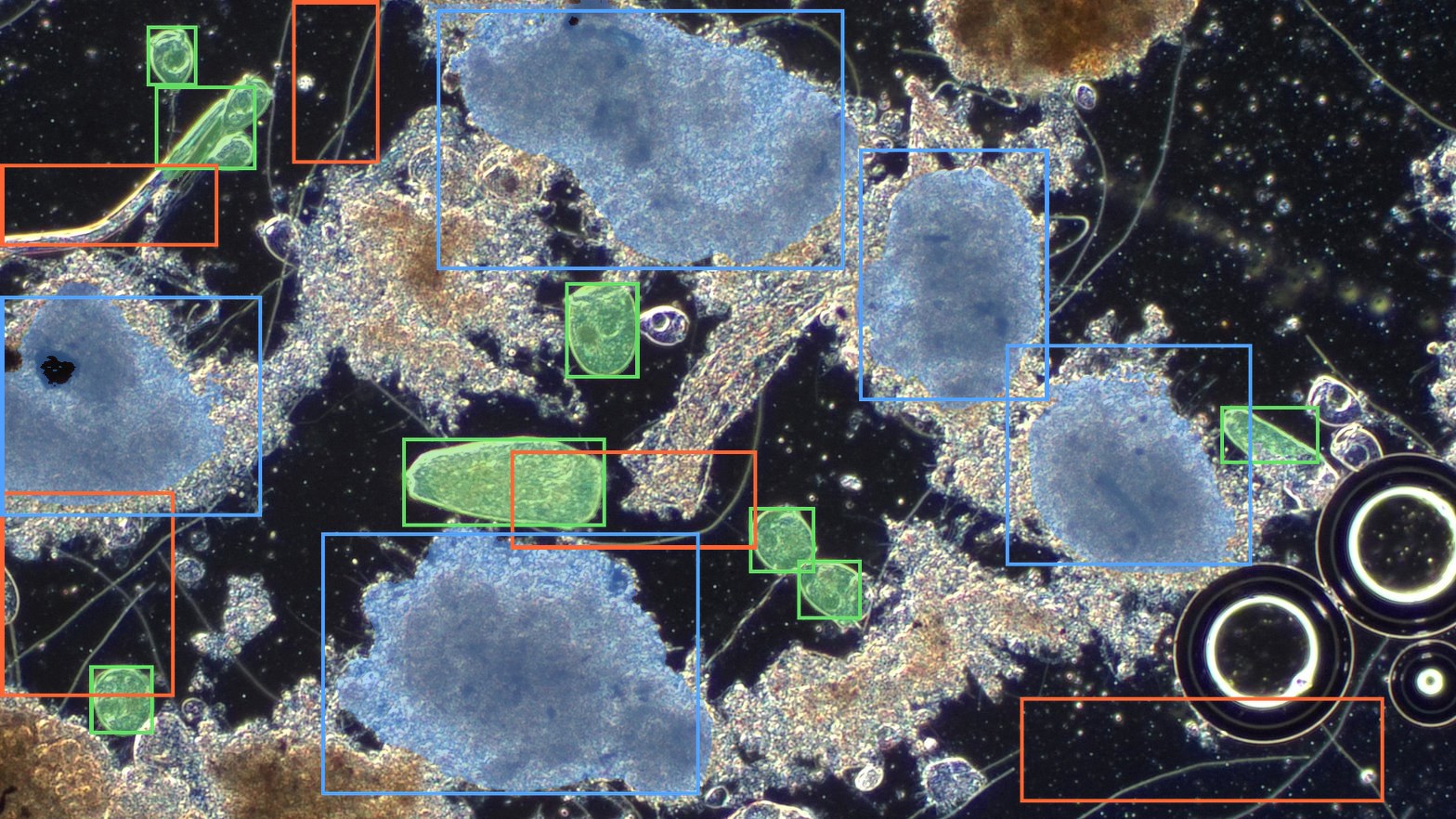 Anonymous plant microscopy sample from April 22 with Nymph AI Vision overlaid.