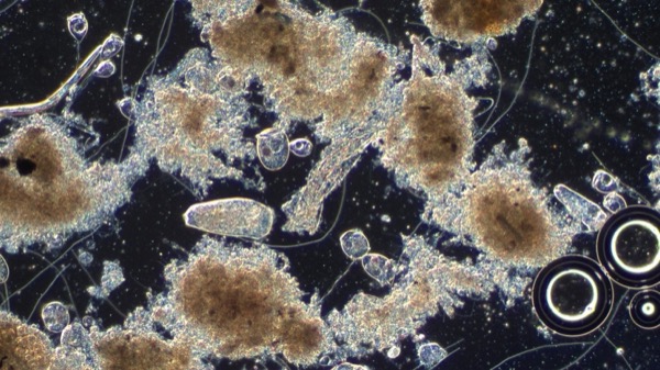 Anonymous plant microscopy sample from April 22 showing early filament warning signs.