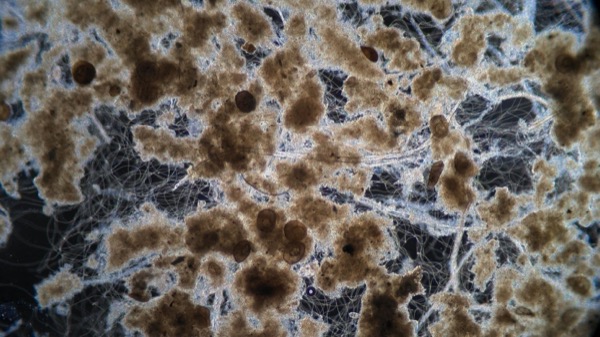 Anonymous plant microscopy sample from May 5 showing upset biology.