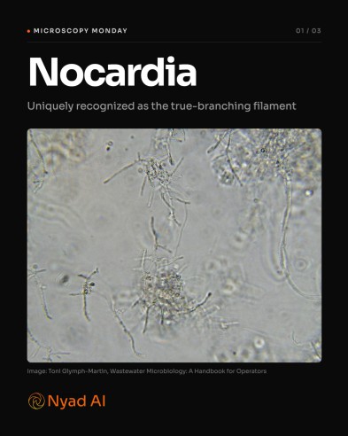 Microscopy Monday carousel featuring Nocardia