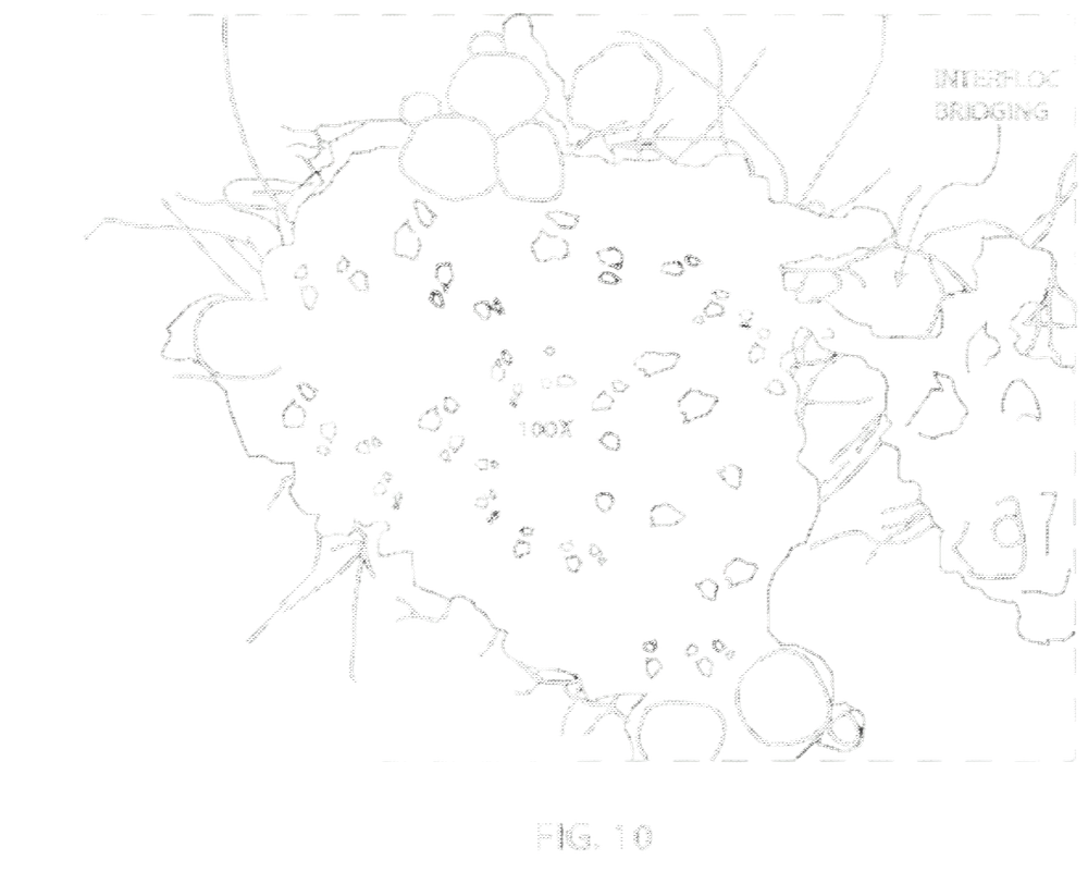 Interfloc bridging microscopy figure